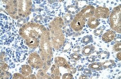 Invitrogen TRNT1 Polyclonal Antibody 100 &mu;L; Unconjugated:Antibodies,