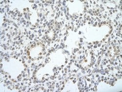 Invitrogen UTP18 Polyclonal Antibody 100 μL; Unconjugated:Antibodies,