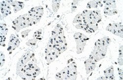 Invitrogen RBM22 Polyclonal Antibody 100 &mu;L; Unconjugated:Antibodies,