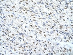 Invitrogen MATR3 Polyclonal Antibody 100 μL; Unconjugated:Antibodies,