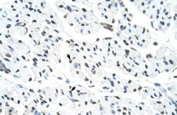 Invitrogen MATR3 Polyclonal Antibody 100 μL; Unconjugated:Antibodies,