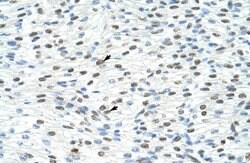 Invitrogen MATR3 Polyclonal Antibody 100 μL; Unconjugated:Antibodies,