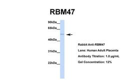 Invitrogen RBM47 Polyclonal Antibody 100 &mu;L; Unconjugated:Antibodies,