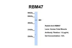 Invitrogen RBM47 Polyclonal Antibody 100 &mu;L; Unconjugated:Antibodies,
