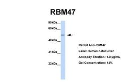 Invitrogen RBM47 Polyclonal Antibody 100 &mu;L; Unconjugated:Antibodies,