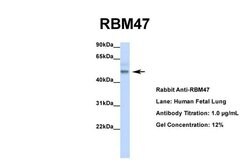 Invitrogen RBM47 Polyclonal Antibody 100 &mu;L; Unconjugated:Antibodies,