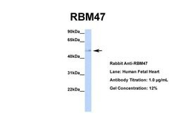 Invitrogen RBM47 Polyclonal Antibody 100 &mu;L; Unconjugated:Antibodies,