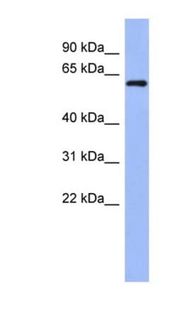 Invitrogen RBM47 Polyclonal Antibody 100 &mu;L; Unconjugated:Antibodies,