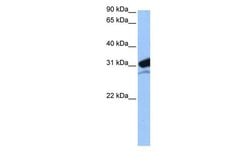 Invitrogen MRPL24 Polyclonal Antibody 100 &mu;L; Unconjugated:Antibodies,
