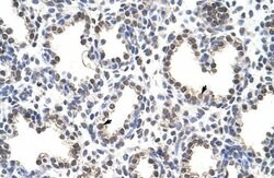 Invitrogen CPSF7 Polyclonal Antibody 100 &mu;L; Unconjugated:Antibodies,