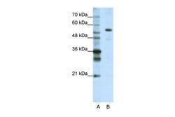 Invitrogen CPSF7 Polyclonal Antibody 100 &mu;L; Unconjugated:Antibodies,