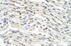 Invitrogen THOC3 Polyclonal Antibody 100 μL; Unconjugated:Antibodies,