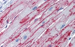 Invitrogen PNPase Polyclonal Antibody 100 μL; Unconjugated:Antibodies,