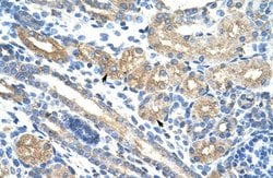 Invitrogen RPUSD2 Polyclonal Antibody 100 &mu;L; Unconjugated:Antibodies,