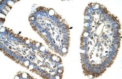 Invitrogen DIS3L2 Polyclonal Antibody 100 &mu;L; Unconjugated:Antibodies,
