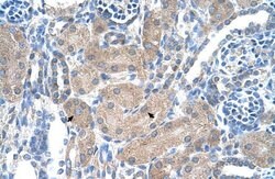 Invitrogen SLA/LP Polyclonal Antibody 100 &mu;L; Unconjugated:Antibodies,