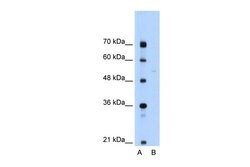 Invitrogen SLA/LP Polyclonal Antibody 100 &mu;L; Unconjugated:Antibodies,