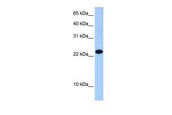 Invitrogen eIF4E3 Polyclonal Antibody 100 &mu;L; Unconjugated:Antibodies,
