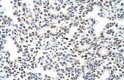 Invitrogen hnRNP A3 Polyclonal Antibody 100 &mu;L; Unconjugated:Antibodies,