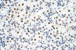 Invitrogen hnRNP A3 Polyclonal Antibody 100 &mu;L; Unconjugated:Antibodies,