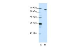 Invitrogen SF1 Polyclonal Antibody 100 &mu;L; Unconjugated:Antibodies,