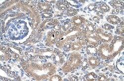 Invitrogen NKCC2 Polyclonal Antibody 100 &mu;L; Unconjugated:Antibodies,