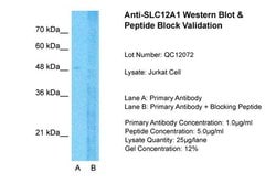 Invitrogen NKCC2 Polyclonal Antibody 100 &mu;L; Unconjugated:Antibodies,