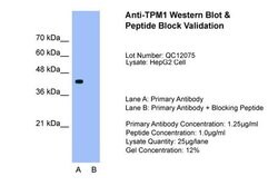 Invitrogen TPM1 Polyclonal Antibody 100 &mu;L; Unconjugated:Antibodies,