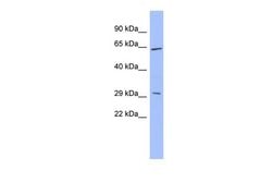 Invitrogen HRG Polyclonal Antibody 100 &mu;L | Buy Online | Invitrogen&trade; | Fisher Scientific