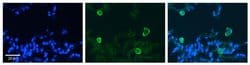 Invitrogen Carbonic Anhydrase IV Polyclonal Antibody 100 &mu;L | Buy Online | Invitrogen&trade; | Fisher Scientific