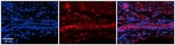 Invitrogen Folate Receptor alpha Polyclonal Antibody 100 &mu;L; Unconjugated:Antibodies,