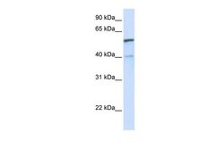 Invitrogen UGT1A6 Polyclonal Antibody 100 &mu;L; Unconjugated:Antibodies,