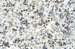 Invitrogen HSD17B6 Polyclonal Antibody 100 &mu;L; Unconjugated:Antibodies,
