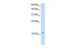 Invitrogen SMPX Polyclonal Antibody 100 &mu;L; Unconjugated:Antibodies,