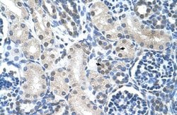 Invitrogen LOR Polyclonal Antibody 100 &mu;L; Unconjugated:Antibodies,