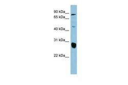 Invitrogen SLC26A4 Polyclonal Antibody 100 &mu;L; Unconjugated:Antibodies,