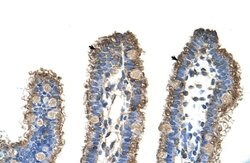Invitrogen RhoBTB1 Polyclonal Antibody 100 &mu;L; Unconjugated:Antibodies,