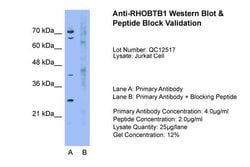 Invitrogen RhoBTB1 Polyclonal Antibody 100 &mu;L; Unconjugated:Antibodies,