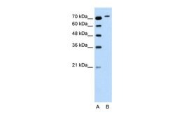 Invitrogen RhoBTB1 Polyclonal Antibody 100 &mu;L; Unconjugated:Antibodies,