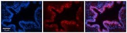 Invitrogen SQLE Polyclonal Antibody 100 μL; Unconjugated:Antibodies,