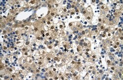 Invitrogen SQLE Polyclonal Antibody 100 μL; Unconjugated:Antibodies,