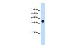 Invitrogen SQLE Polyclonal Antibody 100 μL; Unconjugated:Antibodies,