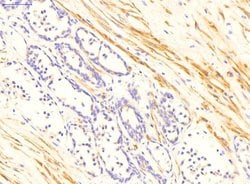 Invitrogen TGM4 Polyclonal Antibody 100 &mu;L; Unconjugated:Antibodies,