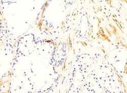 Invitrogen TGM4 Polyclonal Antibody 100 &mu;L; Unconjugated:Antibodies,