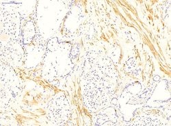Invitrogen TGM4 Polyclonal Antibody 100 &mu;L; Unconjugated:Antibodies,