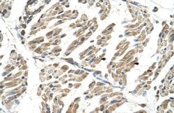 Invitrogen SLC6A8 Polyclonal Antibody 100 &mu;L | Buy Online | Invitrogen&trade; | Fisher Scientific