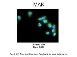 Invitrogen MAK Polyclonal Antibody 100 &mu;L; Unconjugated:Antibodies,