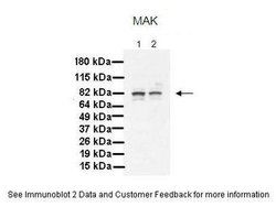 Invitrogen MAK Polyclonal Antibody 100 &mu;L; Unconjugated:Antibodies,