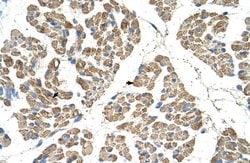 Invitrogen SLC22A7 Polyclonal Antibody 100 &mu;L; Unconjugated:Antibodies,