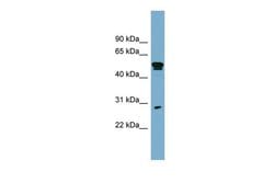 Invitrogen SLA Polyclonal Antibody 100 &mu;L; Unconjugated:Antibodies,